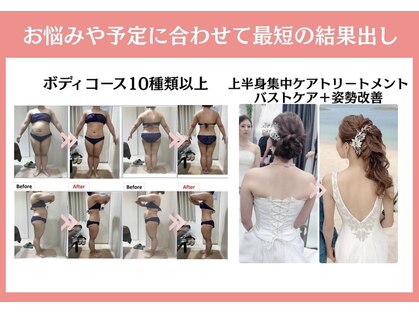 エステティック レイビス 秋田店(RAYVIS)の写真