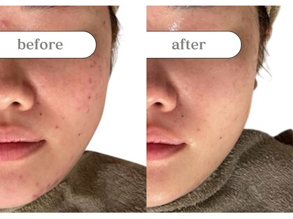 リスタ(RSTA)の写真