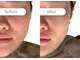 リスタ(RSTA)の写真