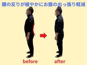 はしもと鍼灸整骨院/腰の反り、お腹の出っ張りが軽減