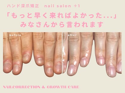 プラスワン(+1)の写真