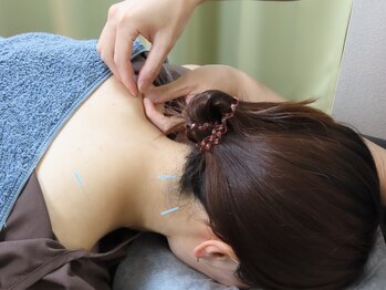 ミトラ鍼灸接骨院 参宮橋の写真/《長年の肩こりに悩まれてる方必見》肩こりは姿勢・ストレス・血行不良等様々な原因で慢性化。