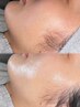 【ツヤ製造】つるん肌を目指す★陶肌(とうき)ピール＋IPS細胞セラム￥13750→