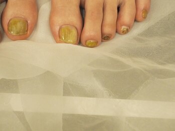 タクミ カルム TAKUMI CALME/フット