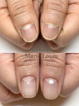 マリーロール 淀屋橋本店(Marie Laure)/自爪育成/深爪矯正/ネイルケア