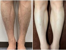 エルマナ(Hermana)/