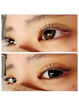 アアルズ(R’s)/