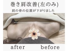 アリサナ(Arisana)の雰囲気（巻き肩改善この変化！肩の可動域が広がります。葛西/バスト）