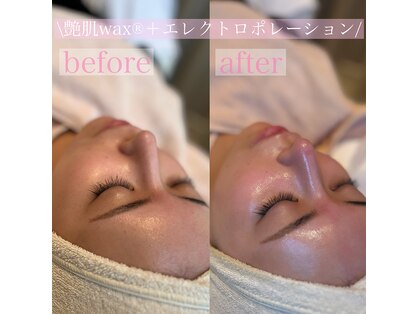 サロンドヴェルノ(salon de VERNO)の写真
