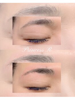 プリンセスアール(Princess R)/美眉トータルケア