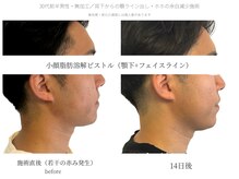 サボラミ(sabor A Mi)/男性も小顔化で印象UP☆