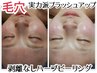 毛穴・肌補正・水光肌☆肌質改善ハーブピーリング+ピュア酵素+幹細胞マスク