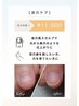 【深爪ケア】深爪さん必見!自爪風スカルプで自然な手元に。