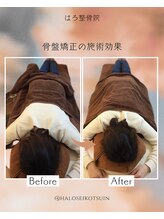 はろ整骨院/骨盤矯正【歪み/O脚/足の長さ】