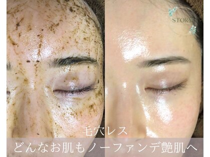 ストーリー 沼津店(STORY)の写真