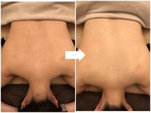 ヴァン ベール 那覇店/シェービング+美肌ケア