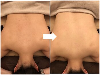 ヴァン ベール 那覇店/シェービング+美肌ケア