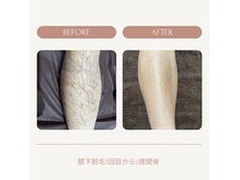 シュエット(Chouette)の雰囲気（新潟初導入!最先端LED脱毛☆効果が早い/痛み少/ピンポイント脱毛）