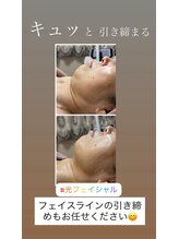 顔凛(カオリン)/フェイスラインもスッキリ