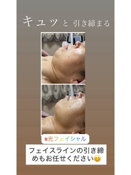 顔凛(カオリン)/フェイスラインもスッキリ