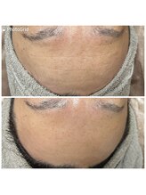 private salon Ponola【ポノーラ】/バンテージ