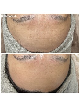 private salon Ponola【ポノーラ】/バンテージ