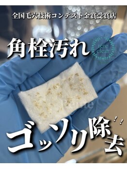 レーヌ(Reine)/毛穴エクストラクション