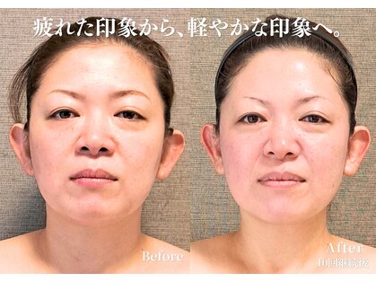 バンブー(bamboo)の写真