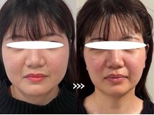 エステビジン 八事(エステBIZIN)の雰囲気（貴方のお顔やボディのお悩みをお聞きかせください【小顔/痩身】）