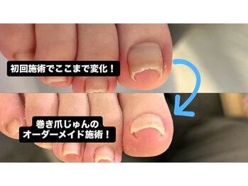 巻き爪じゅん 千葉駅前店の写真/【千葉駅徒歩2分】完全プライベートフットケア専門店◎お手頃価格で通いやすい!むくみ・冷えのお悩み解消!