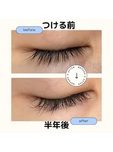 脱毛サロン ブラジリアンワックス ミーケアー(Mecare)/まつ毛美容液