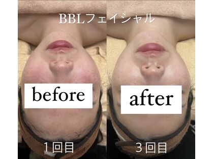 ソルテ(soRte)の写真