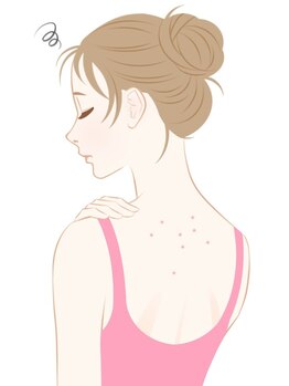 ロンド(Lond)/背中のニキビケアにもBBL