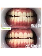 ルブラン 奈良店(Le Blanc)/この機会お見逃しなく！！