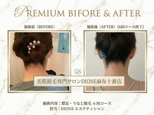 ディオーネ 麻布十番(Dione)の雰囲気（【ビフォーアフター】効果主義だから何でも相談できるが嬉しい♪）