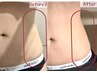 【最新美容☆REDSHOT導入】落ちにくいお腹くびれコース¥12,000→