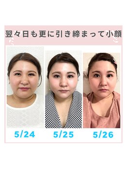 ビューティスタジオＫ/施術の翌日や翌々日の顔が好き