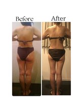 ラヴィニティ 池袋店(Lavinity)/ダイエットなら痩身専門店