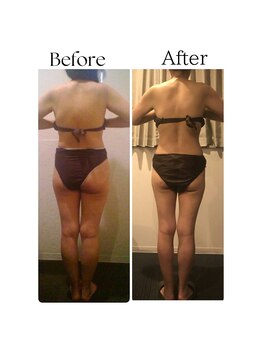 ラヴィニティ 池袋店(Lavinity)/ダイエットなら痩身専門店