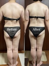 ヴィム(VIM)/ハイパーナイフビフォーアフター