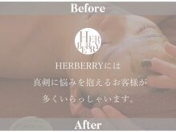 ハーバリー ハーブピーリング 難波心斎橋店(HERBERRYハーブピーリング)/なんばハーブピーリングHERBERRY