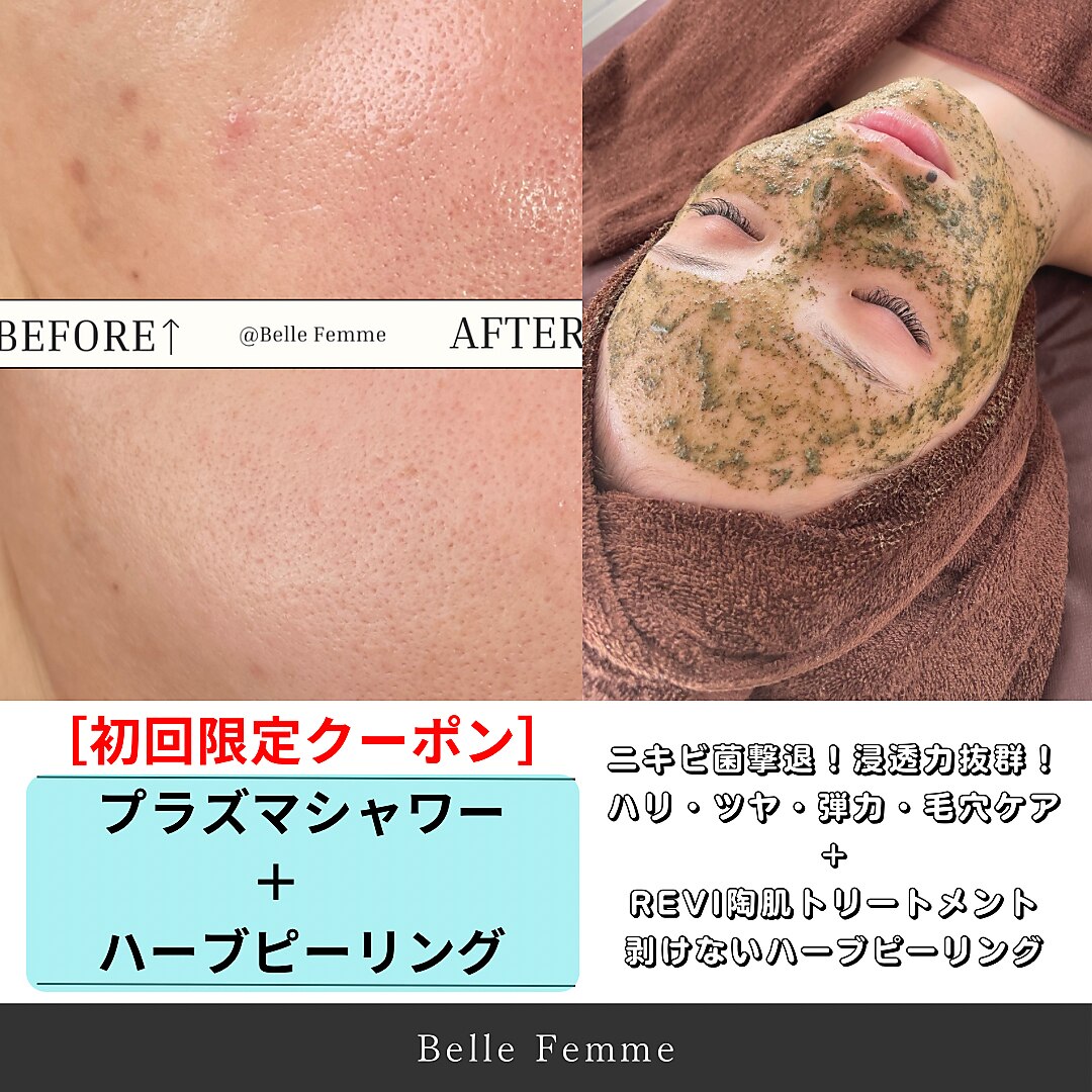 REVI ハーブピーリング 大阪に関するエステサロン 心斎橋 REVI