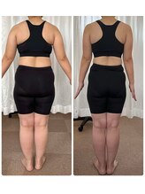 シュシュ/耳ツボダイエット40代