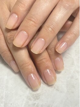 爪の悩みを解消できる（ケア含む）