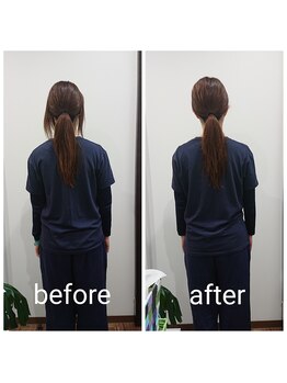 ベラージュ/小顔リフト・フレームアップケア