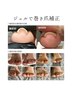 【フット巻き爪ケア】専用ジェルで巻き爪補正（アロマフットバス付き）