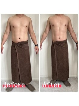 ボニート 堺東店(BONITO)/痩身☆ビフォーアフター