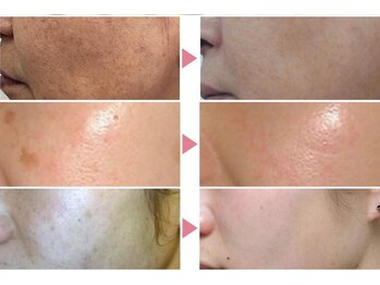 リアン(Lien)/DOCスキンケア本気の肌改善♪