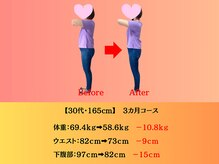 穴田鍼灸整骨院/【３０代　女性】ダイエット