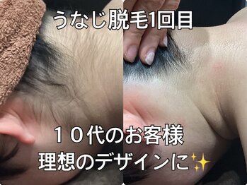 リエル(RIEL)/【うなじ脱毛】